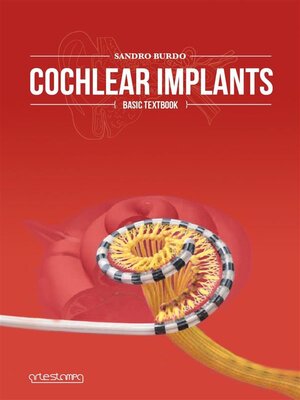 cover image of Cochlear Implants--Basic Textbook